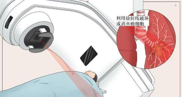 《攻略肿瘤医生》（挑战第十关的肿瘤医生攻略）  第1张